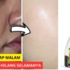 Bagaimana cara menggunakan minyak zaitun untuk wajah flek hitam
