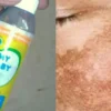 manfaat minyak telon untuk wajah