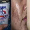 manfaat susu bear brand untuk wajah