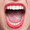 Bau Mulut Tidak Sedap Padahal Rutin Sikat Gigi? Mungkin 4 ini Sebabnya!