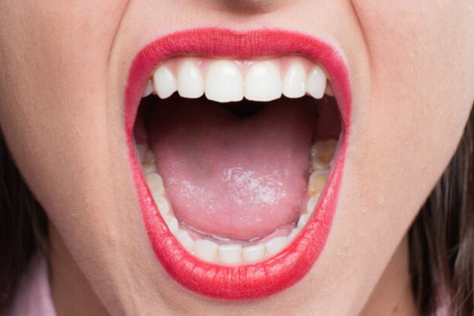 Bau Mulut Tidak Sedap Padahal Rutin Sikat Gigi? Mungkin 4 ini Sebabnya!